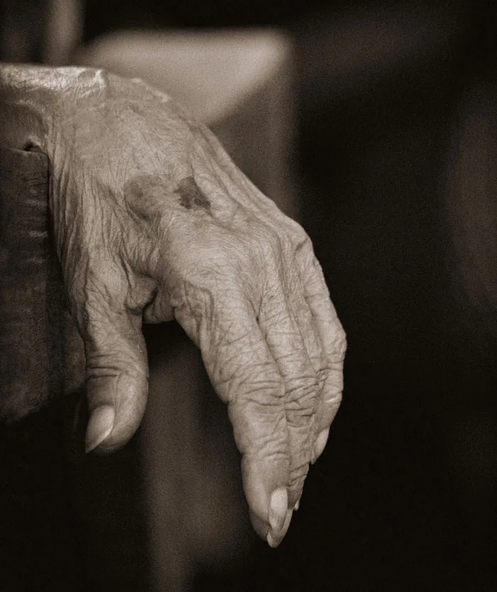 A close-up of an elderly wrinkled hand, representing bizarre and unexpected discoveries found during autopsies.