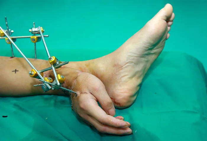 38 Fotos médicas que demuestran que el cuerpo es a veces aterrador