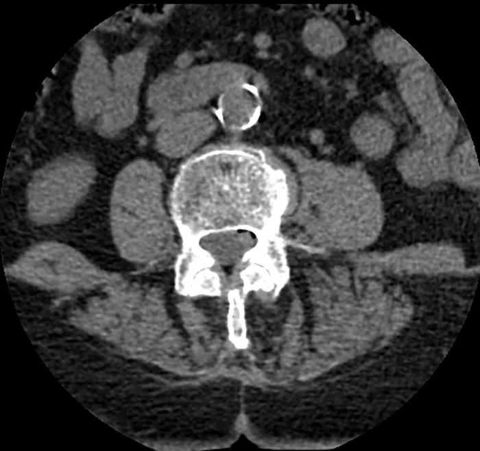CT scan showing a bizarre and unexpected discovery found during autopsies in the abdominal area.