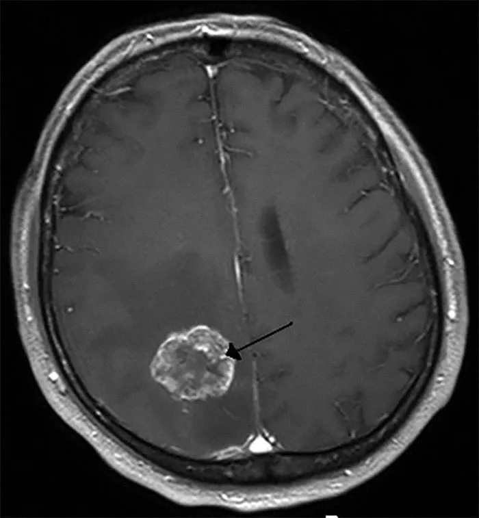 45 Autopsy Experts Reveal Their Weirdest And Most Unique Finds: “There Was No Brain”