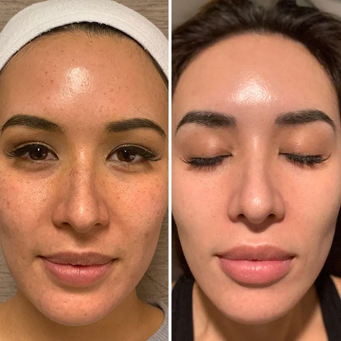 Primer plano de mujer mostrando pequeños cambios de apariencia que marcaron la diferencia en su piel y rostro.