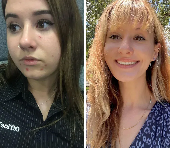 (22 años) Extremadamente deprimida y dependiente de la bebida para pasar el día VS ahora (27 años) Sobria, extremadamente feliz de estar viva y sentirme bendecida todos los días