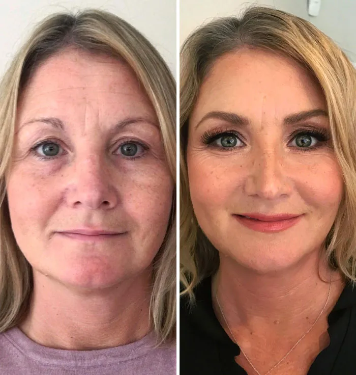 Before and after image showing small appearance changes enhancing a woman's look and confidence for noticeable difference.