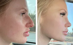 36 Mujeres comparten sus pequeños cambios de apariencia que marcaron la diferencia para ellas