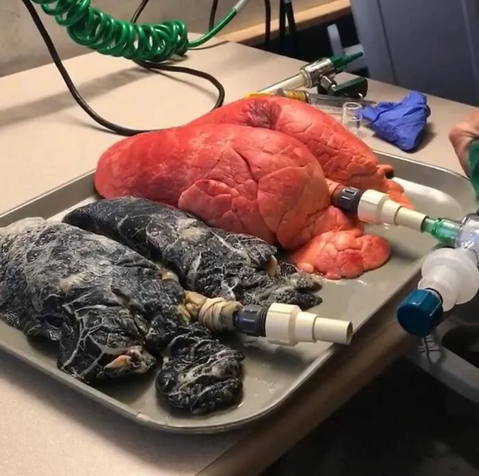 Una comparación gráfica entre unos pulmones sanos y los de un fumador empedernido