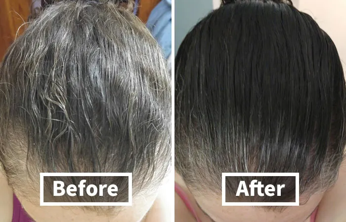 Give Your Scalp The Spa Treatment It Deserves And Tell Those Thinning Strands It's Glow-Up Time With <a Style="Display:inline;" Href="Https://Www.amazon.com/Biotin-Hair-Shampoo-Thinning-Moisturizing/Dp/B01encboa0?ie=utf8&th=1&linkcode=ll1&tag=bpgrape-20&linkid=4c9a526a749f1786a7a3626c46dbb4cd&language=en_us&ref_=as_li_ss_tl" Target="_blank"><span Style="Font: Inherit; Color: #d74b1f;"> Rosemary And Biotin Shampoo For Thinning Hair </Span>
