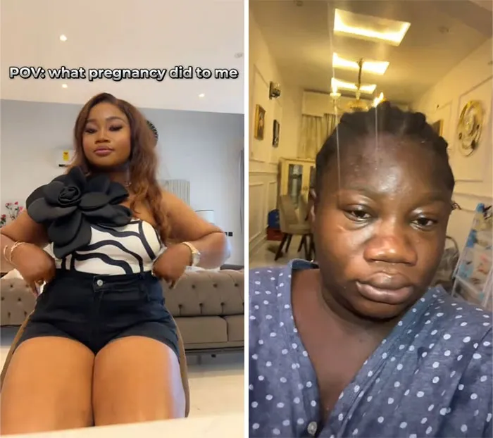 Women Are Sharing What They Looked Like Before Getting Pregnant To Highlight Extreme Changes