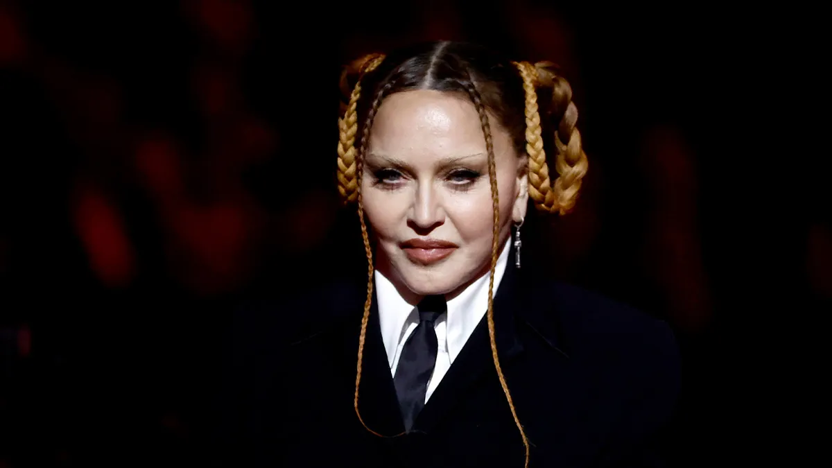 “The Worst Thing That I Ever Did”: 19 Celebrities Before And After Plastic Surgery