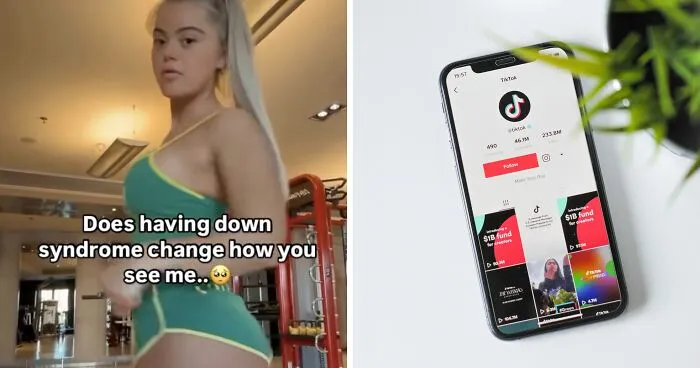 "Gross" Social Media Trend Capitalizing On Down Syndrome For Adult Content Faces Backlash