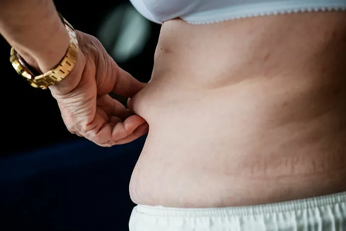 30 Body Changes Showing That Someone Is Gradually (Or Swiftly) Getting Old