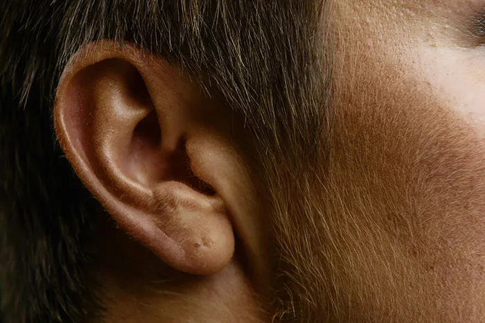 “They Put Duct Tape On Blistered Skin”: 50 Times Doctors Saved Patients From Their DIY Treatments
