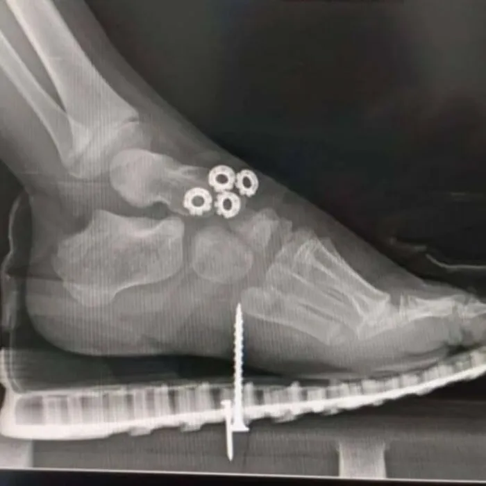 38 Fotos médicas que demuestran que el cuerpo es a veces aterrador