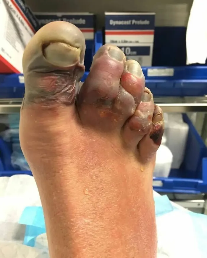 50 Medical Pics That Prove The Body Keeps The Score, And Sometimes It’s Absolutely Terrifying