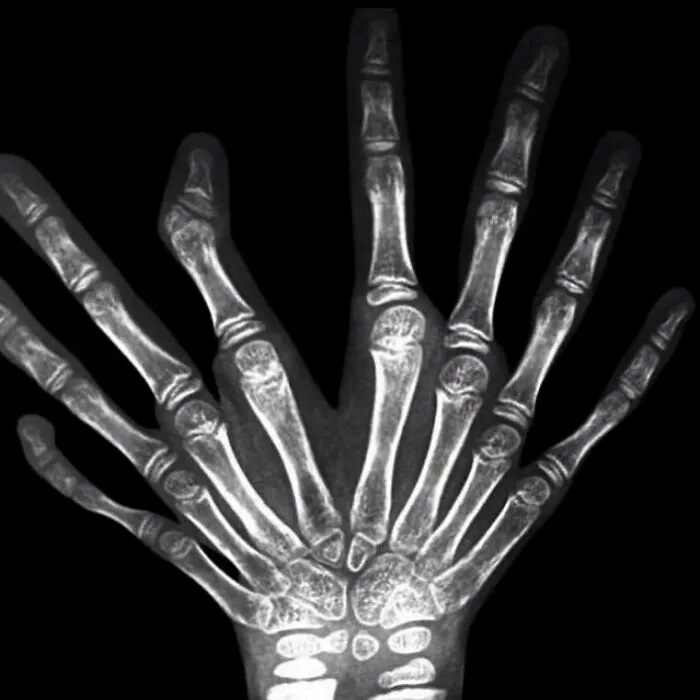 38 Fotos médicas que demuestran que el cuerpo es a veces aterrador