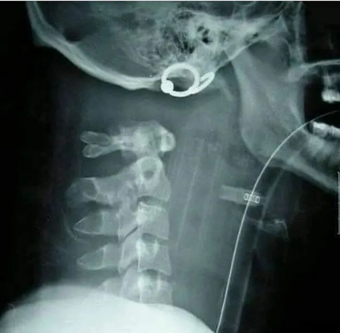 38 Fotos médicas que demuestran que el cuerpo es a veces aterrador
