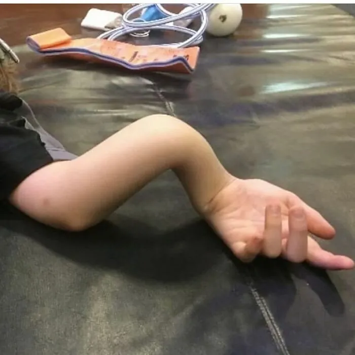 38 Fotos médicas que demuestran que el cuerpo es a veces aterrador