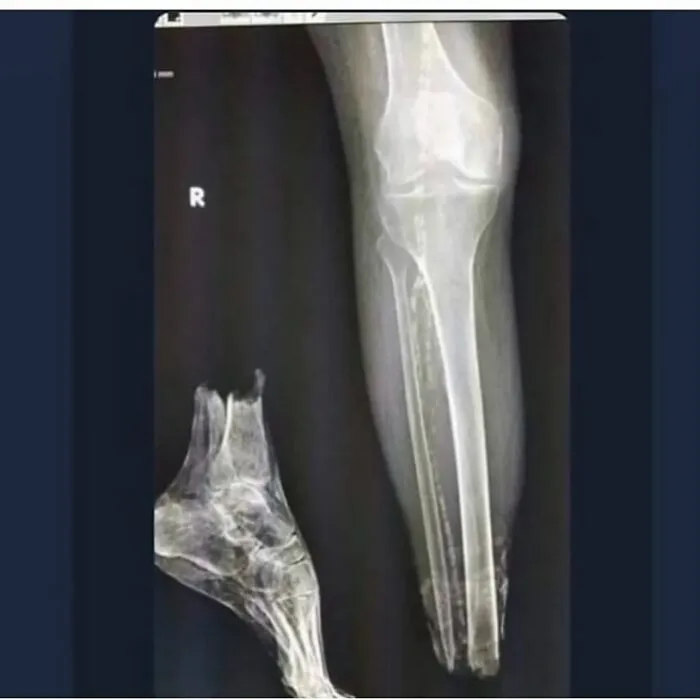 38 Fotos médicas que demuestran que el cuerpo es a veces aterrador