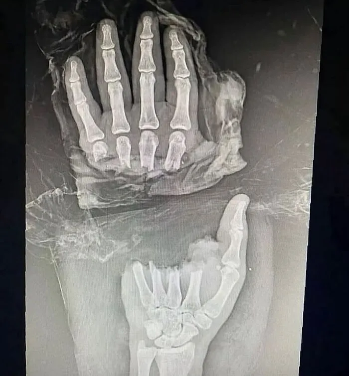 38 Fotos médicas que demuestran que el cuerpo es a veces aterrador