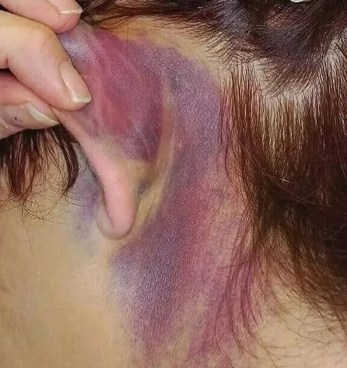 38 Fotos médicas que demuestran que el cuerpo es a veces aterrador
