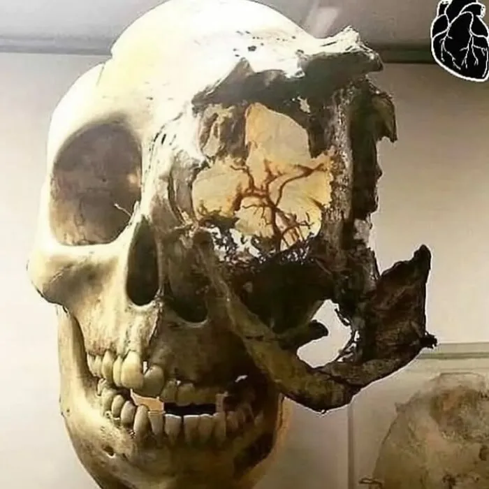 38 Fotos médicas que demuestran que el cuerpo es a veces aterrador