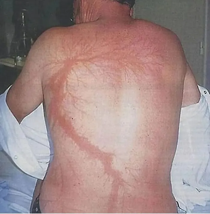 38 Fotos médicas que demuestran que el cuerpo es a veces aterrador