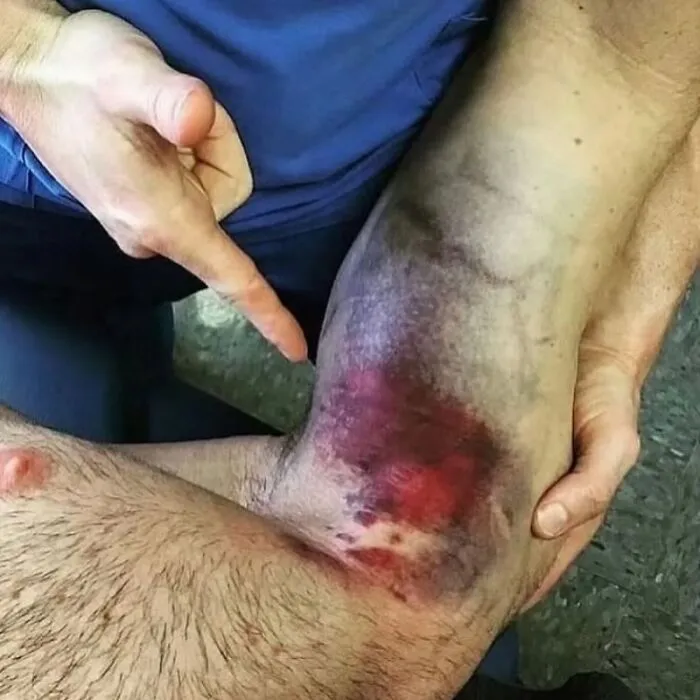 38 Fotos médicas que demuestran que el cuerpo es a veces aterrador