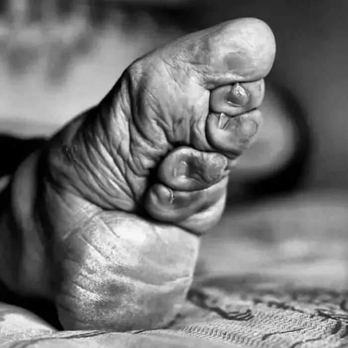 38 Fotos médicas que demuestran que el cuerpo es a veces aterrador