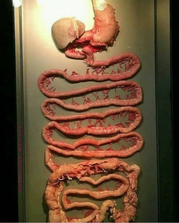 38 Fotos médicas que demuestran que el cuerpo es a veces aterrador