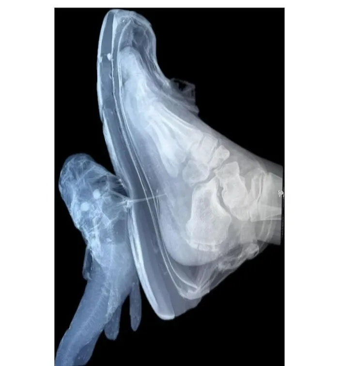 38 Fotos médicas que demuestran que el cuerpo es a veces aterrador
