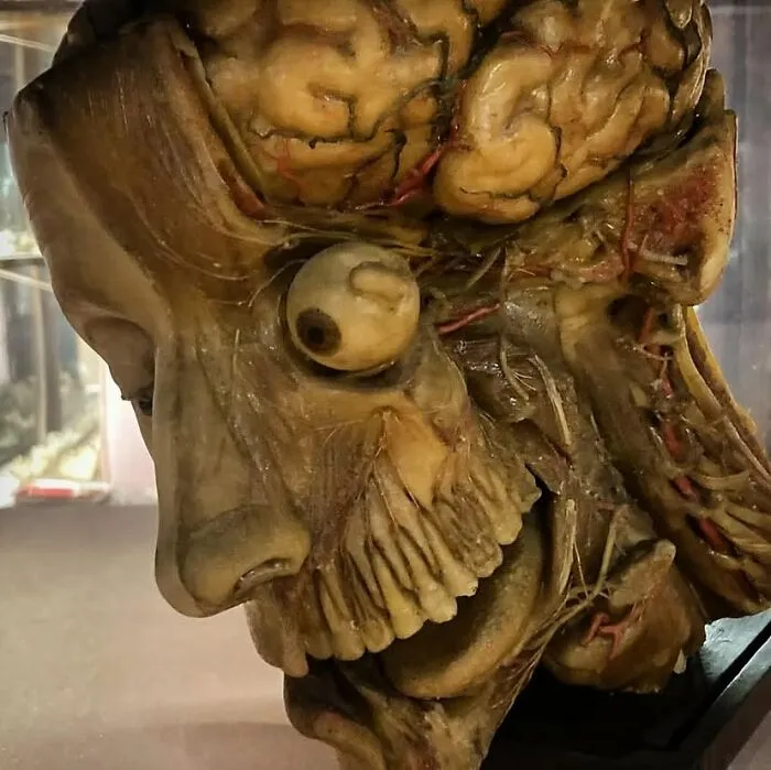 38 Fotos médicas que demuestran que el cuerpo es a veces aterrador