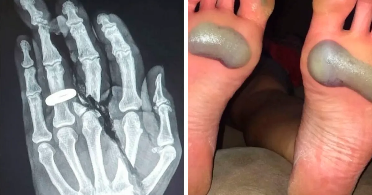 38 Fotos médicas que demuestran que el cuerpo es a veces aterrador