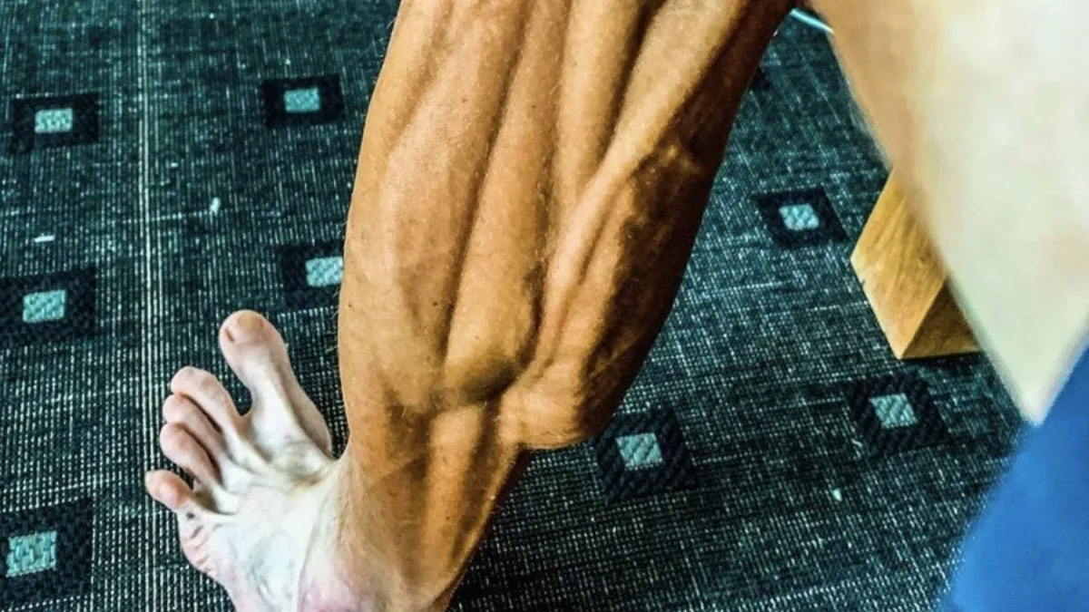 Ever Wondered What A Year-Old Banana Looks Like? Here Are 50 Interesting Posts Just Like That