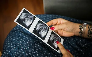 “Big Chunk Of It Stays Behind”: 45 Childbirth Facts That Might Be Hard To Stomach