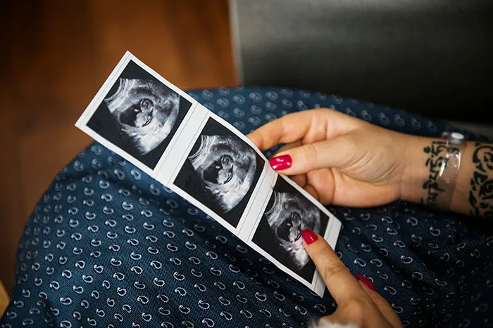 “Big Chunk Of It Stays Behind”: 45 Childbirth Facts That Might Be Hard To Stomach