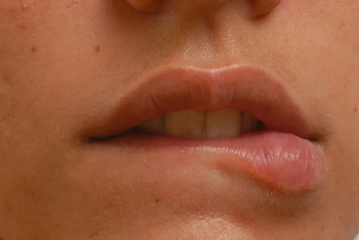 Adults Mortified When They Realized That Their 32 Habits As Kids Were Actually Red Flags