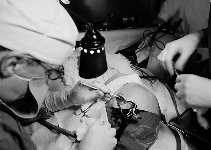 Black and white photo of historic medical surgery showing detailed tools and a patient's leg under surgical procedure.