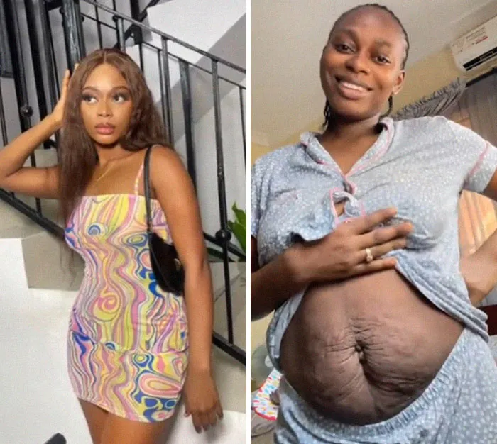 30 Women Share Comparison Pics Of Before And After Becoming Moms Which Took Away Their Spark