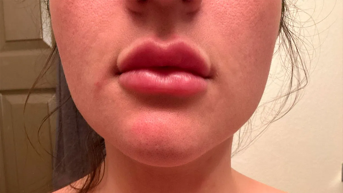 “Bee Sting Lips”: 50 Men Reveal Petty Dealbreakers They Think Women Don’t Notice