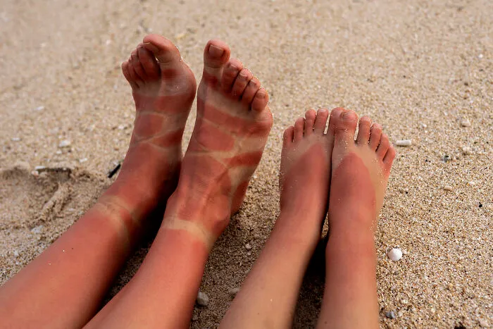 30 Netizens With Various 'Medically Cool' Body Traits Share Things They Are Happy (Or Not) To Have