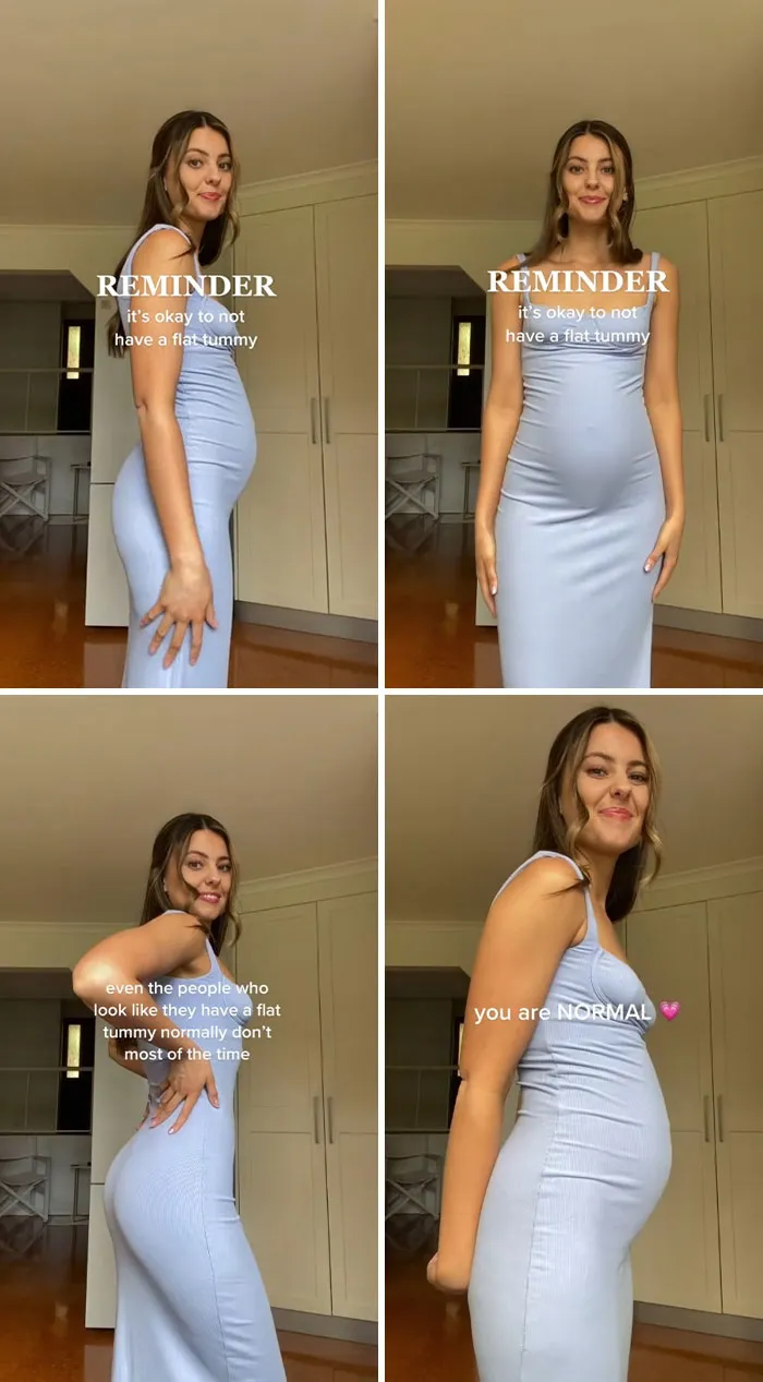 40 Women Tired Of “Skinny-Tok” Show What Unedited Bodies Look Like