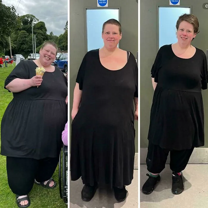 F/36/5’5” [450lbs > 247lbs] (11 Months) I Said I’d Update You All On My Journey So Here It Is!