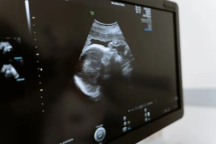 “Don't Google It”: 40 Of The Weirdest And Most Unusual Things Seen In Human Bodies