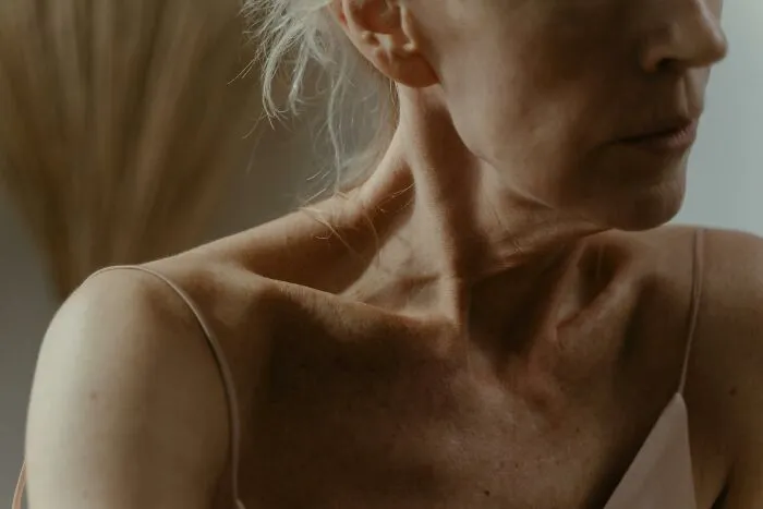 Close-up of an older woman showing body changes that indicate aging on her neck and shoulder area.