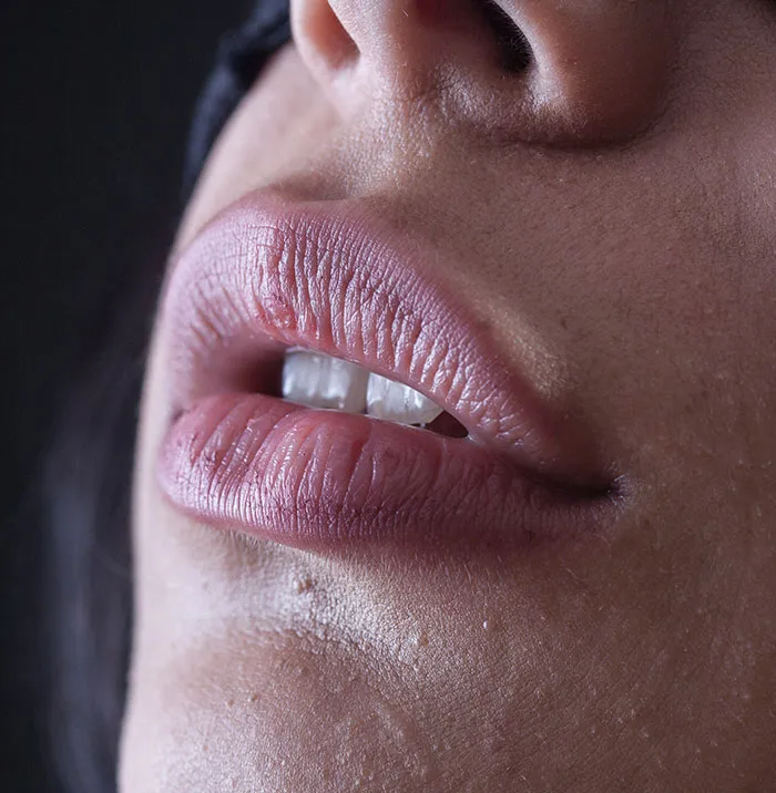 "Don't Ignore These": 45 Symptoms People Swear Are More Serious Than They Seem