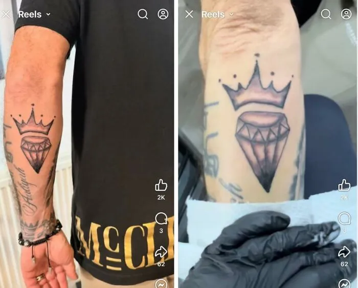 Man's arm with a tattoo of a crown and diamond, showing an example of hilariously bad tattoos and inkshaming fails