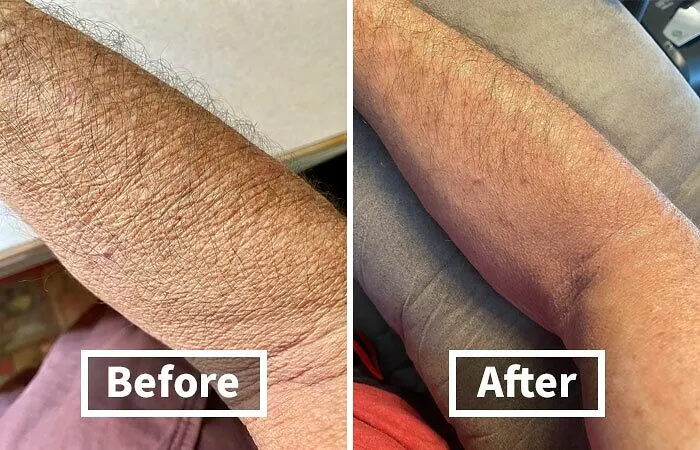 Get Ready For Your Skin To Have A Bigger Comeback Story Than Jennifer Coolidge With A <a Style="Display:inline;" Href="Https://Www.amazon.com/Advanced-Clinicals-Professionals-Moisturizing-Penetrates/Dp/B00di9iiek?ie=utf8&th=1&linkcode=ll1&tag=bpbison-20&linkid=bd6cd0b37bfddd30dcf71ee9834e3d0f&language=en_us&ref_=as_li_ss_tl" Target="_blank">    <span Style="Font: Inherit; Color: #d74b1f;"> Retinol Body Lotion & Face Moisturizer </Span>