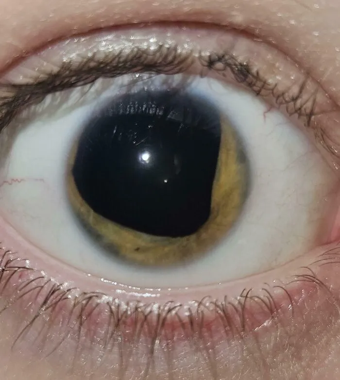Casi no tengo color en el ojo