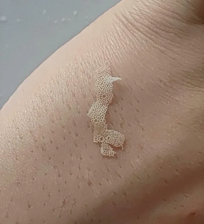 Piel humana con capa de piel muerta desprendida, mostrando textura y detalle en imágenes curiosas del cuerpo humano.