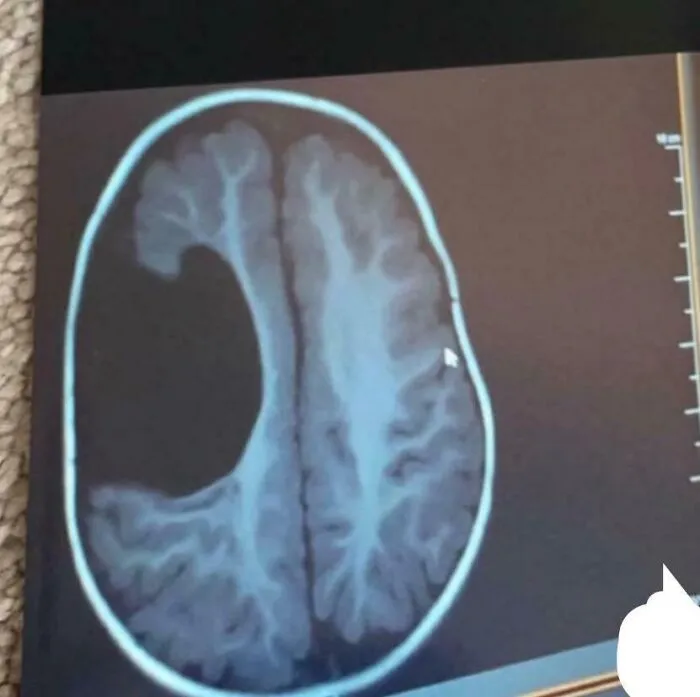 Resonancia magnética de mi cerebro. Sí, es real.