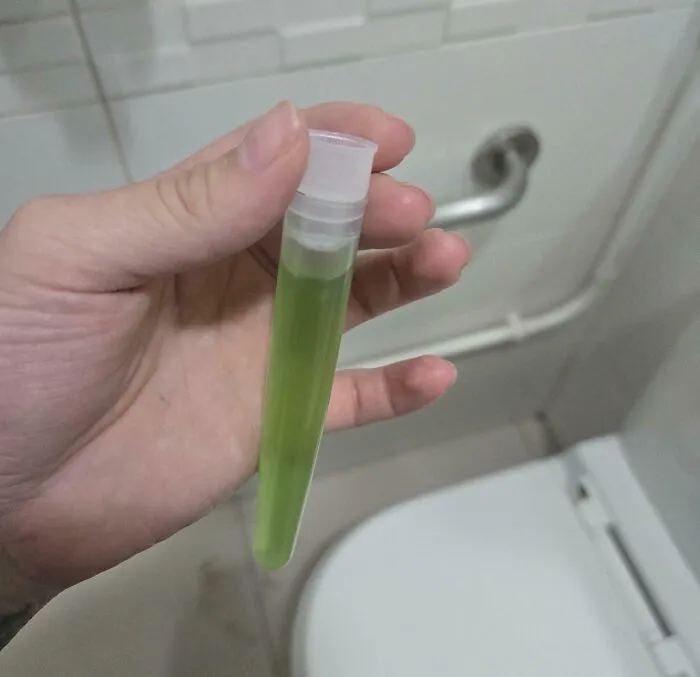 Mano sosteniendo tubo con líquido verde, detalle curioso para imágenes del cuerpo humano y sus secretos.
